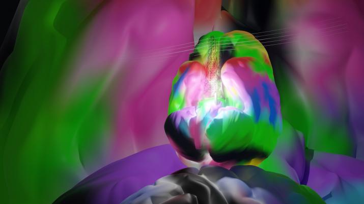 a brain in psychedelic colors with a powerline overlaid on top
